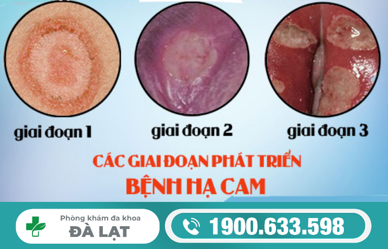 Hình ảnh minh họa